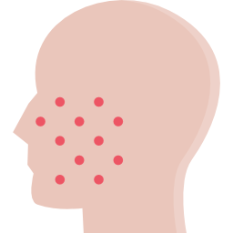 What are the causes of eczema on face